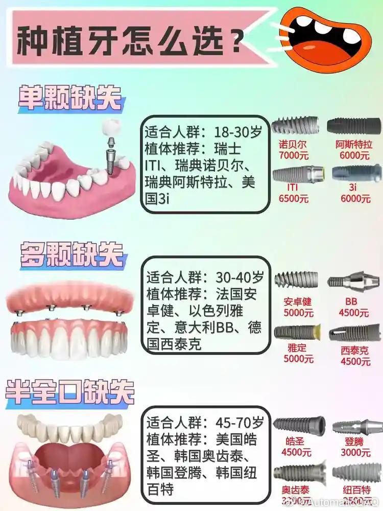 革新牙齿修复之选，最新种植牙技术揭秘
